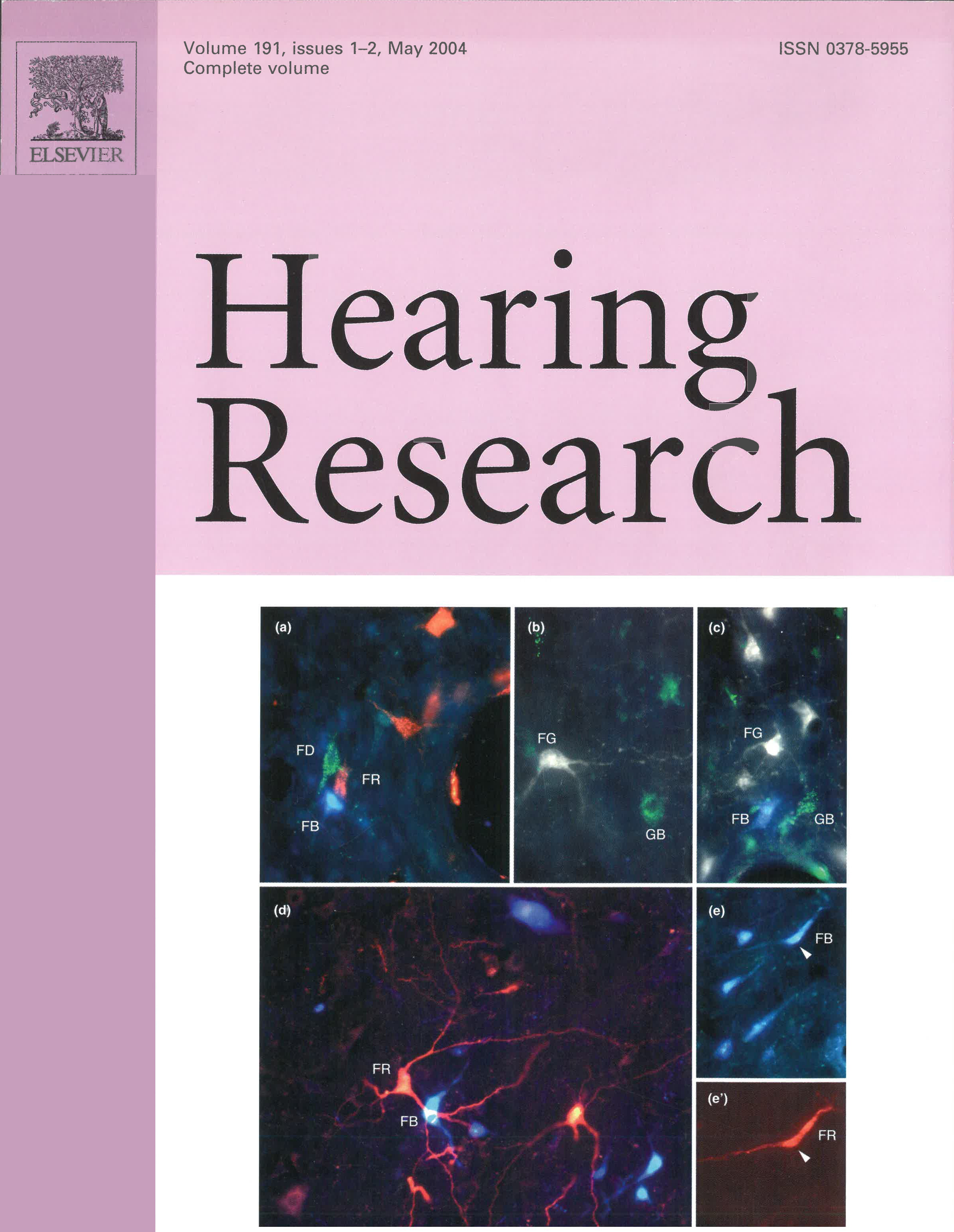 Cover for Hearing Research, Volume 191, Issues 1 and 2. Published May 2004. Purple background and showing digital photomicrographs of labeled cells in the IC.